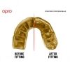 Chránič zubů pro uživatele fixních rovnátek - Opro GOLD BRACES - 4