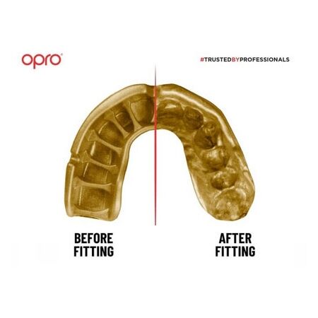 Chránič zubů pro uživatele rovnátek - Opro GOLD BRACES - ROVNÁTKA - 5
