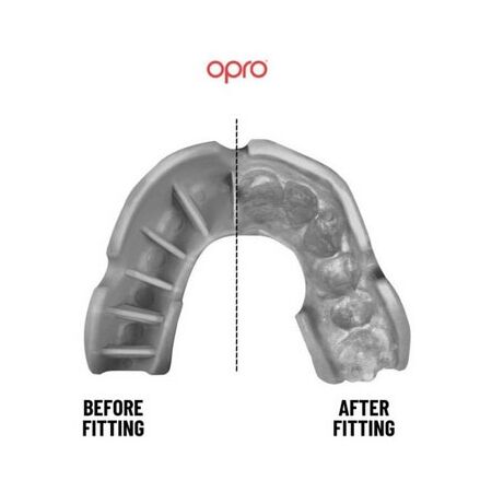 Chránič zubů - Opro SILVER JUNIOR - 4
